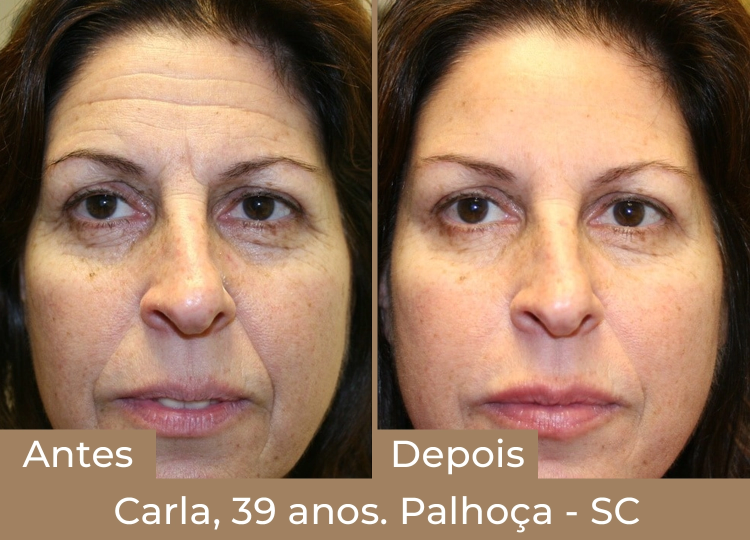 carla 39 anos