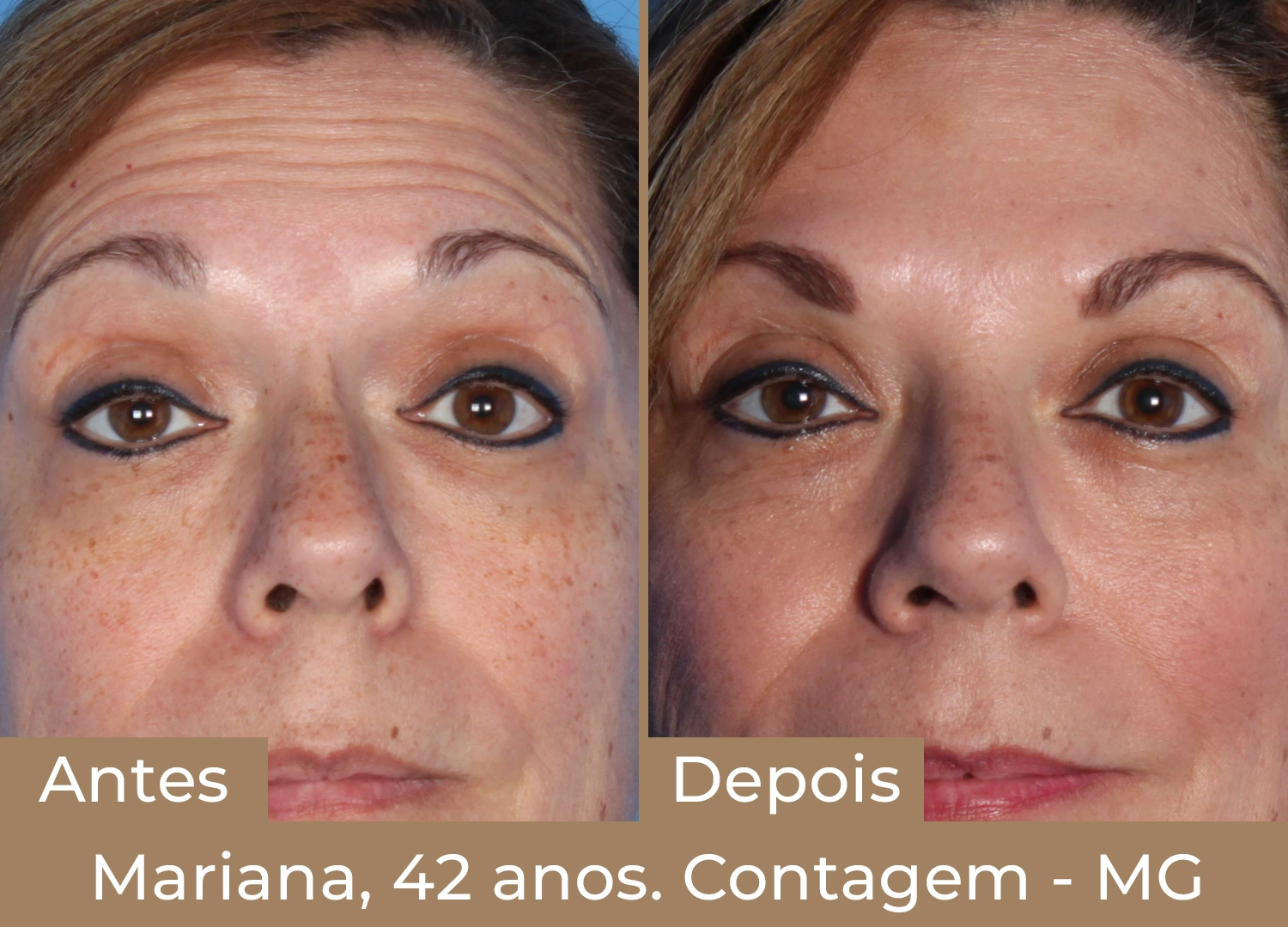 mariana 42 anos